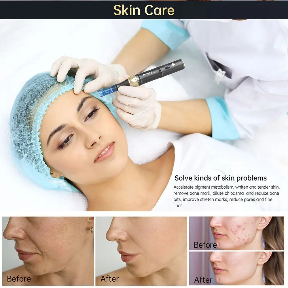 Dr. Pen Ultima A8S Wireless Microneedling Derma Pen